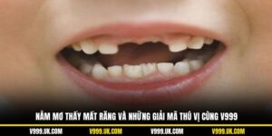 Nằm Mơ Thấy Mất Răng Và Những Giải Mã Thú Vị Cùng V999
